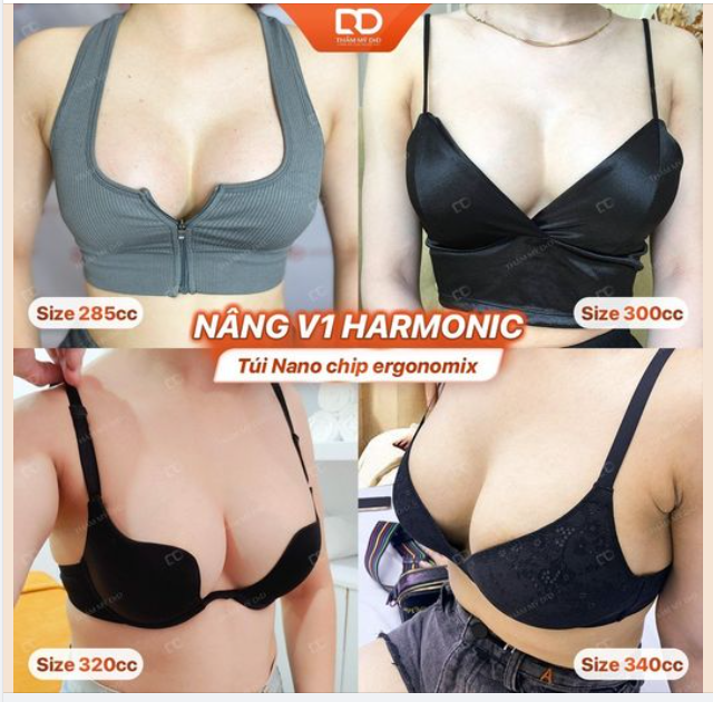 2 lý do phổ biến của KH khi thực hiện nâng V1 nội soi Harmonic tại DrD