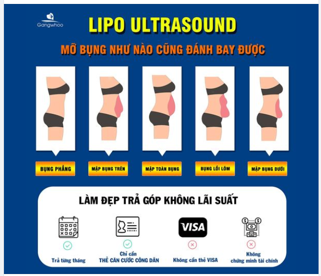 LIPO ULTRASOUND - MỠ BỤNG NHƯ NÀO LÀM 1 LẦN LÀ ĐẸP