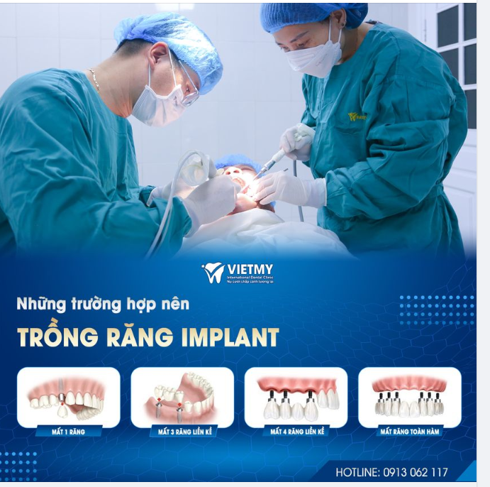 NHỮNG TRƯỜNG HỢP NÀO NÊN CẤY GHÉP IMPLANT
