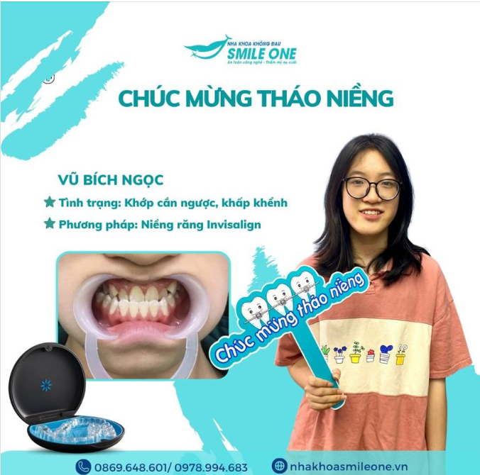 Chúc mừng  bạn Vũ Bích Ngọc đã xuất sắc về đích trên hành trình niềng răng của mình!