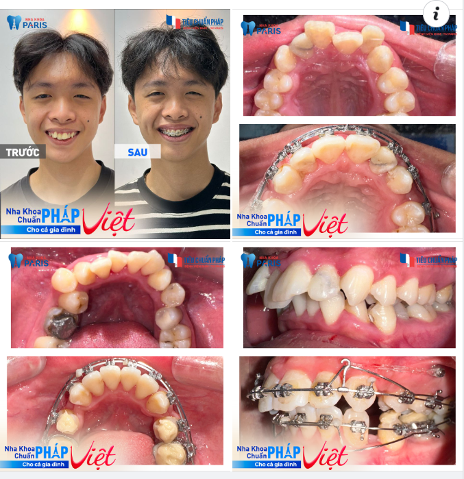 “Gọi bác sĩ chỉnh nha là nghệ nhân bởi mỗi một nụ cười đều là cả một nghệ thuật”