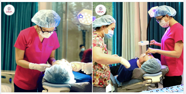 TIÊM LÀM ĐẦY KHUYẾT LÕM NHƯNG MẮT DƯỚI BỊ PHÌNH TO, NHIỀU NẾP GẤP, TRÔNG NẶNG NỀ, GIÀ NUA VÌ SAO?