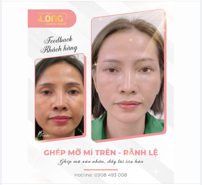 GIẢI MÃ “ÁNH NHÌN” GIÚP KHÁCH HÀNG ĐẸP LÊN TRÔNG THẤY