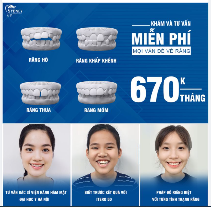NIỀNG RĂNG MẮC CÀI KIM LOẠI Ở ĐÂU TỐT?