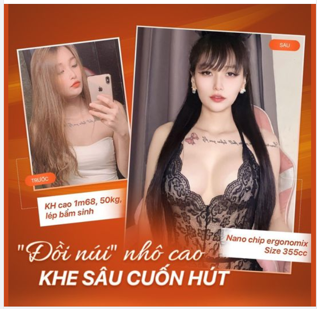 NGỰC PHẲNG SÂN BAY - HOÁ NGAY ĐỒI NÚI