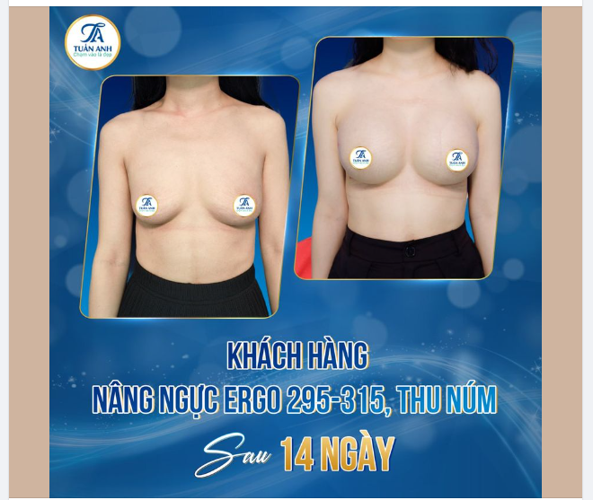 NGỰC LÉP À! THÂN ÁI, VĨNH BIỆT VÀ KHÔNG HẸN GẶP LẠI!