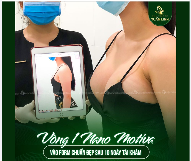 Túi nâng cao cấp an toàn, tự nhiên, tròn đều, gợi cảm - được FDA chứng nhận an toàn, hạn chế bao xơ co thắt, cho hiệu quả thẩm mỹ lâu dài.