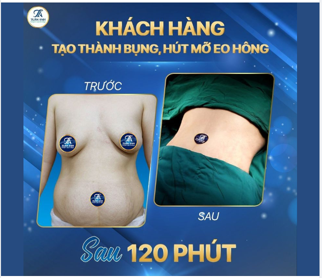 CHĂM SÓC VẺ ĐẸP – TRẺ HÓA TINH THẦN