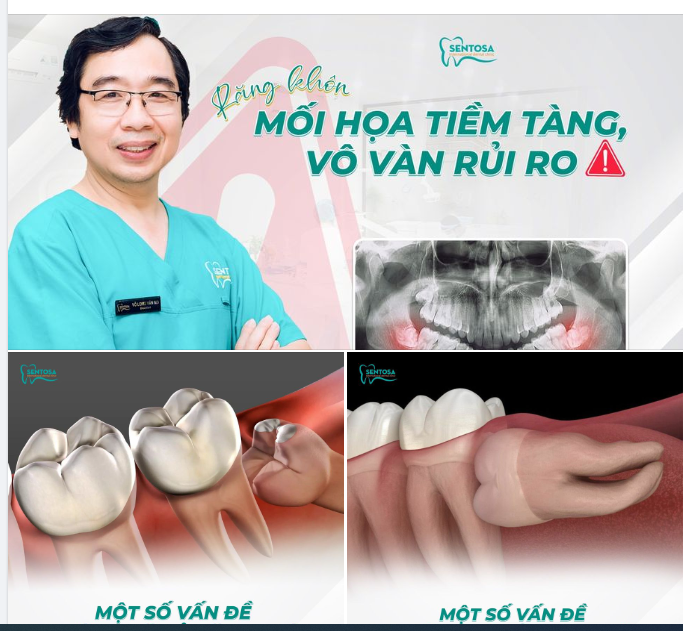 RĂNG KHÔN" MỐI HỌA TIỀM TÀNG, VÔ VÀN RỦI RO