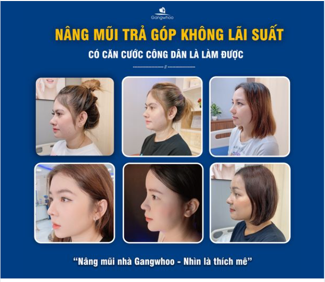 NÂNG MŨI NHÀ GANGWHOO - NHÌN LÀ THÍCH MÊ
