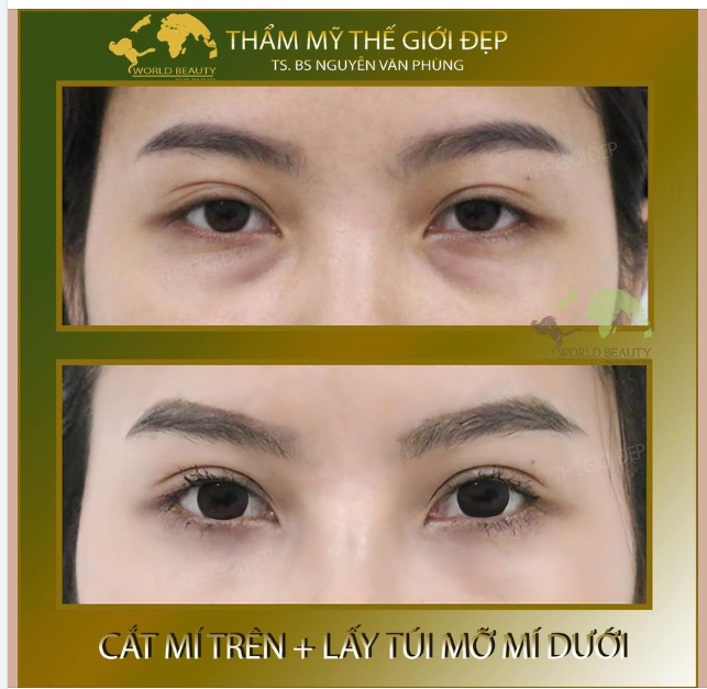 Loạt khiếm khuyết về đôi mắt mà khách hàng đã gặp phải: