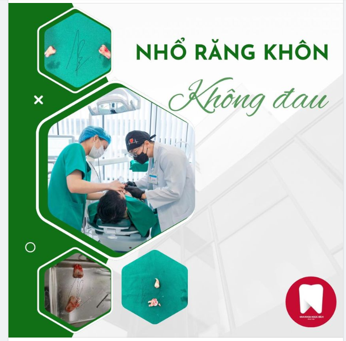 Nhổ răng khôn nhẹ nhàng, không đau tại Nha Khoa Ngọc Bích