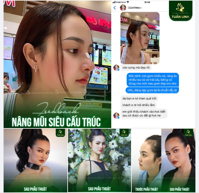 Feedback nâng mũi thế này đã đủ UY TÍN chưa ạ?