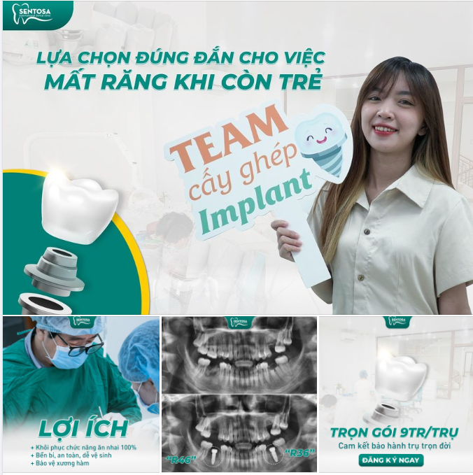 CẤY GHÉP IMPLANT LỰA CHỌN ĐÚNG ĐẮN CHO VIỆC MẤT RĂNG KHI CÒN TRẺ