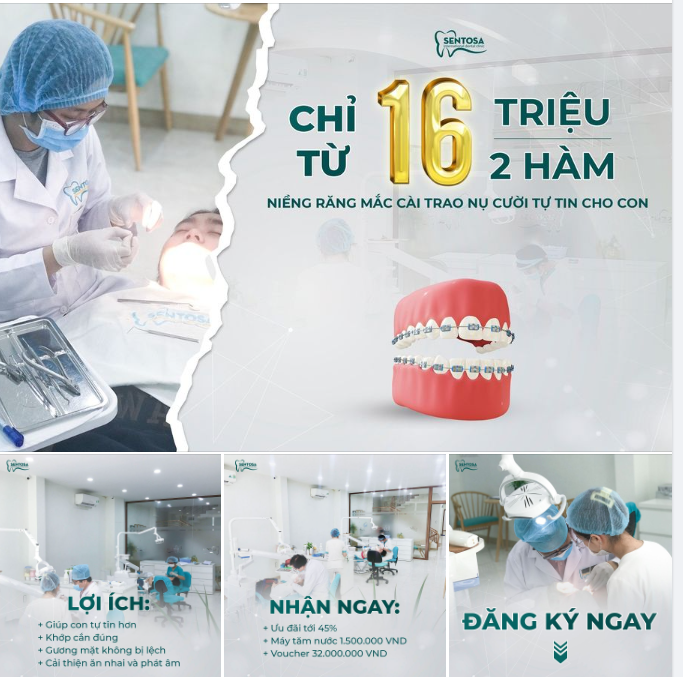 CHỈ TỪ 16 TRIỆU/2 HÀM NIỀNG RĂNG MẮC CÀI TRAO NỤ CƯỜI TỰ TIN CHO CON