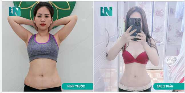 EM CỦA PHIÊN BẢN HIỆN TẠI: ĐẸP HƠN, TỰ TIN HƠN