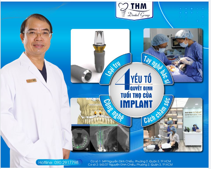 "TUỔI THỌ" CỦA TRỤ IMPLANT PHỤ THUỘC VÀO YẾU TỐ NÀO?