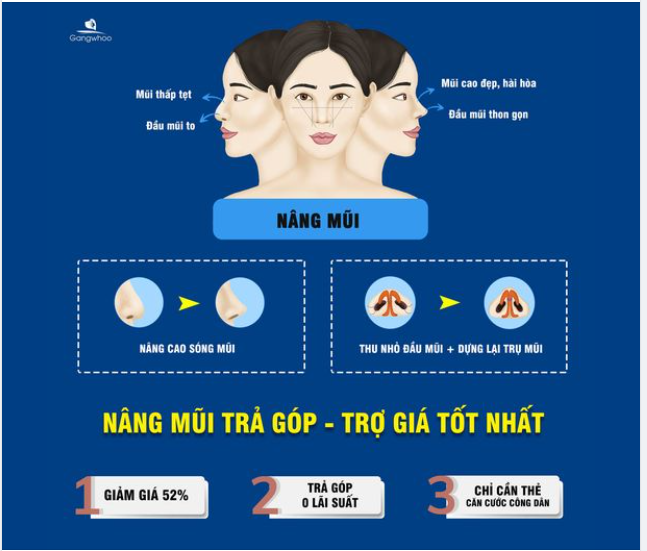 NÂNG MŨI TRẢ GÓP - TRỢ GIÁ TỐT NHẤT CHO BẠN