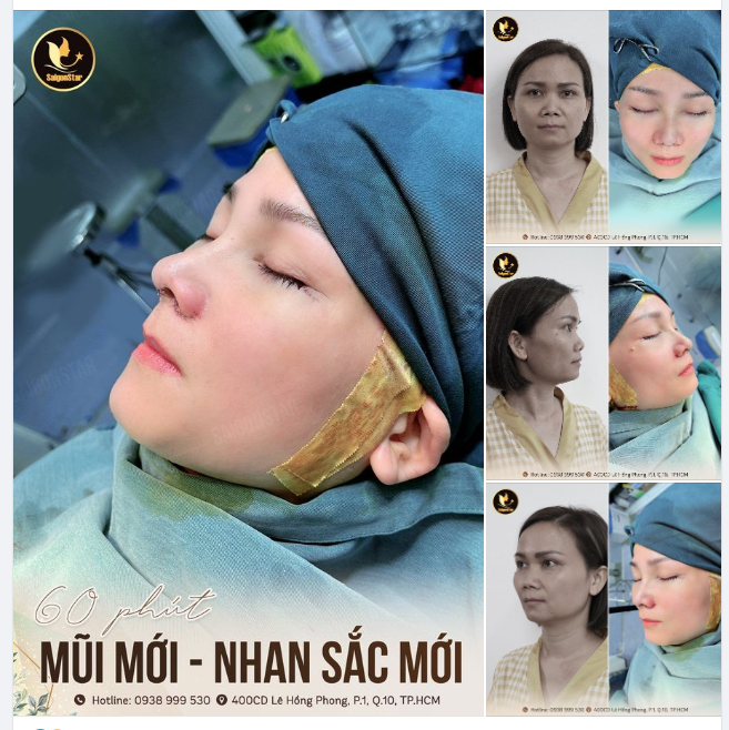 60 PHÚT SỞ HỮU MŨI MỚI – NHAN SẮC MỚI
