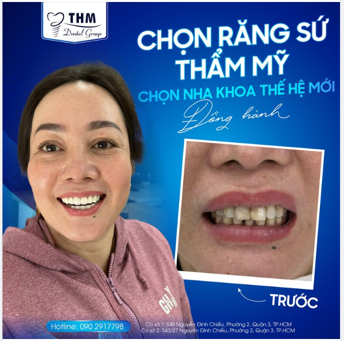 CHỌN RĂNG SỨ THẨM MỸ - CHỌN NHA KHOA THẾ HỆ MỚI ĐỒNG HÀNH