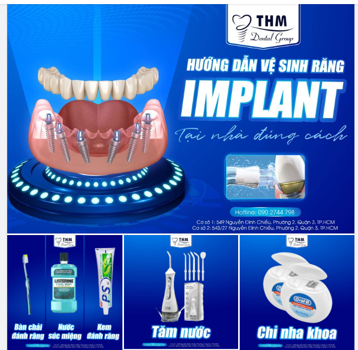 HƯỚNG DẪN VỆ SINH RĂNG IMPLANT TẠI NHÀ ĐÚNG CÁCH!