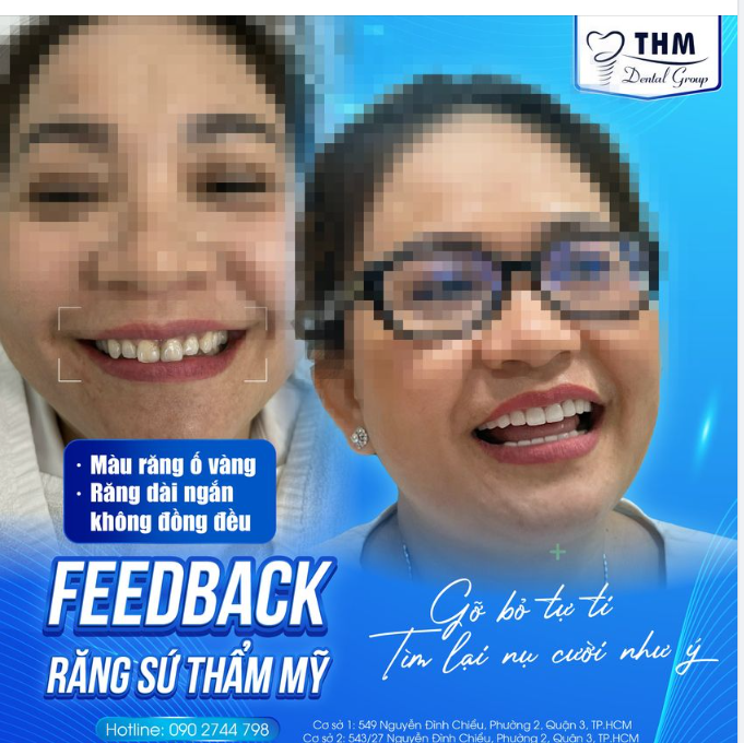 GỠ BỎ TỰ TI - TÌM LẠI NỤ CƯỜI NHƯ Ý VỚI RĂNG SỨ THẨM MỸ TẠI NHA KHOA THẾ HỆ MỚI
