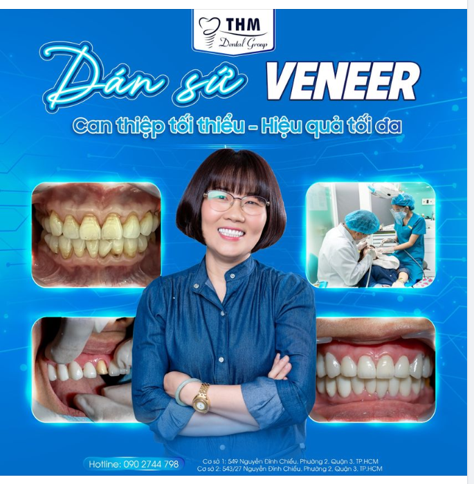 DÁN SỨ VENEER - CAN THIỆP TỐI THIỂU, HIỆU QUẢ TỐI ĐA