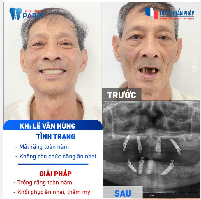 Niềm hạnh phúc nhất của con cái là bố mẹ được ăn ngon sống khỏe!