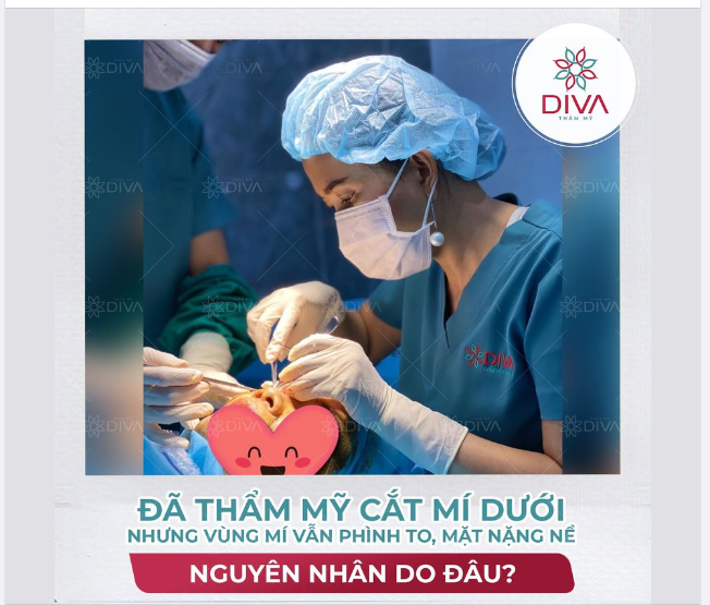 ĐÃ TRẢI QUA THẨM MỸ CẮT MÍ MẮT DƯỚI NHƯNG VÙNG MÍ DƯỚI VẪN PHÌNH TO, MẶT NẶNG NỀ - NGUYÊN NHÂN LÀ GÌ?