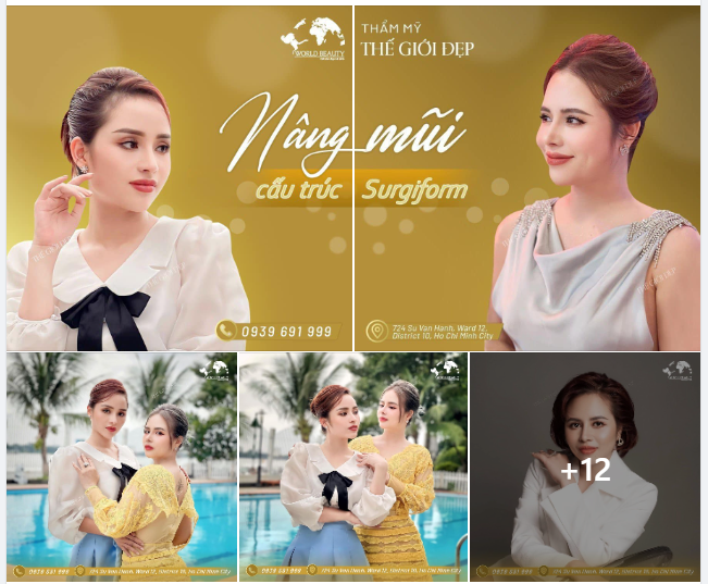 Cả 2 Chị em đều đã từng n.âng cấp mũi bằng chất làm đầy và phương pháp n.âng mũi thông thường trước đó nhưng chưa hài lòng.