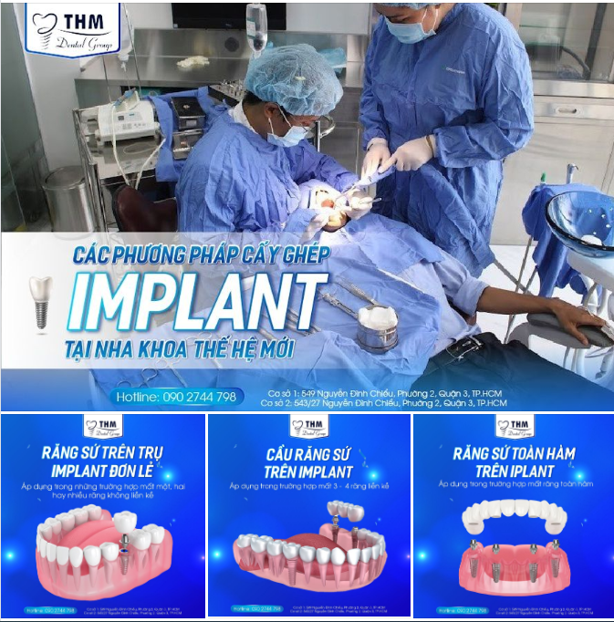 CÁC PHƯƠNG PHÁP PHỤC HÌNH RĂNG SỨ TRÊN IMPLANT
