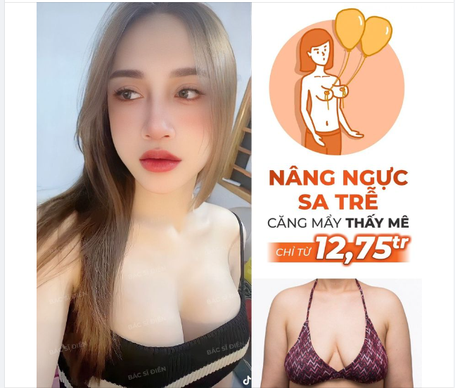 V1 HÉO HON - HOÁ "BƯỞI" CĂNG TRÒN
