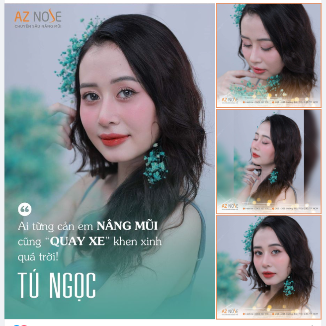 "Hồi đó mẹ em nói nhìn "được" rồi, nâng mũi làm chi. Bây giờ thì khen con gái tấm tắc luôn!"