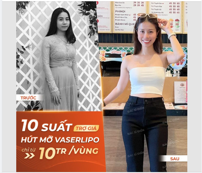 HẠ SIZE VÒNG 2 - TÌM LẠI VÒNG EO 56CM