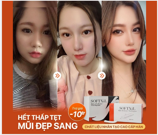 HẾT THẤP TẸT - MŨI ĐẸP SANG