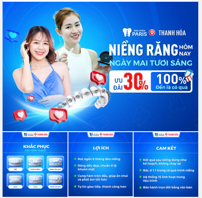 RẠNG RỠ NỤ CƯỜI VỚI NIỀNG RĂNG