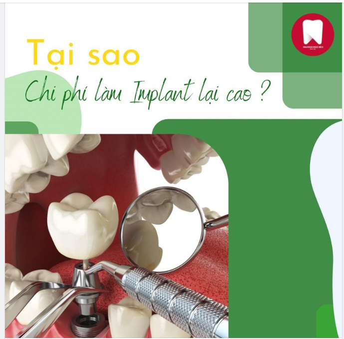 VÌ SAO CHI PHÍ IMPLANT LẠI ĐẮT