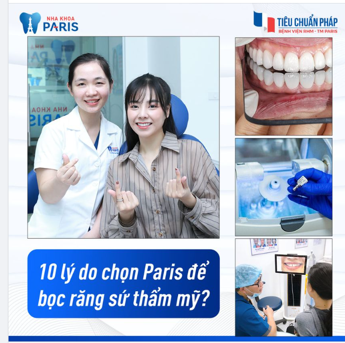 10 lý do để bạn chọn Paris bọc răng sứ thẩm mỹ!