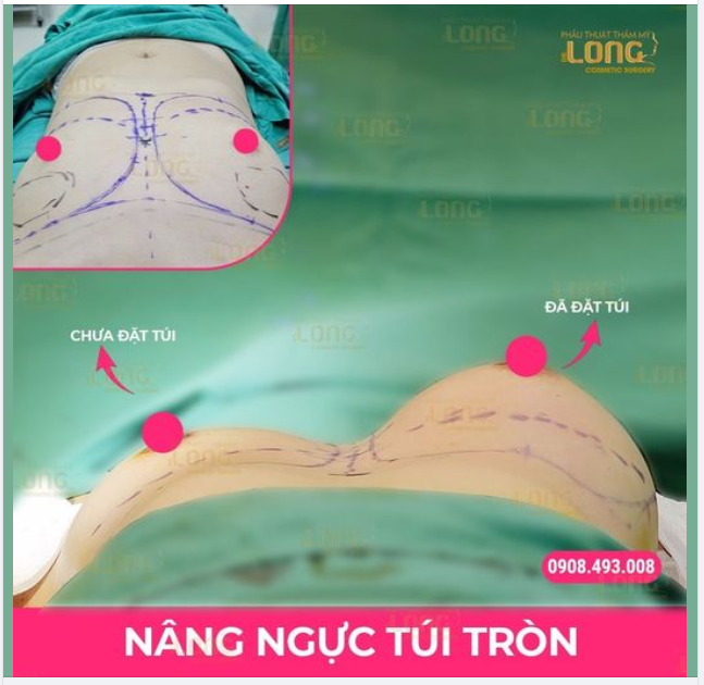 ĐỘ LOA SIÊU TỐC - BẬT GỐC TÌNH TRẠNG LÉP, XẸP. NHỎ LÂU NĂM