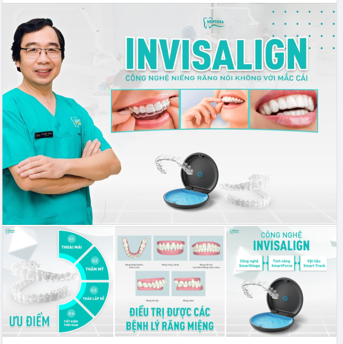 INVISALIGN - CÔNG NGHỆ NIỀNG RĂNG NÓI KHÔNG VỚI MẮC CÀI