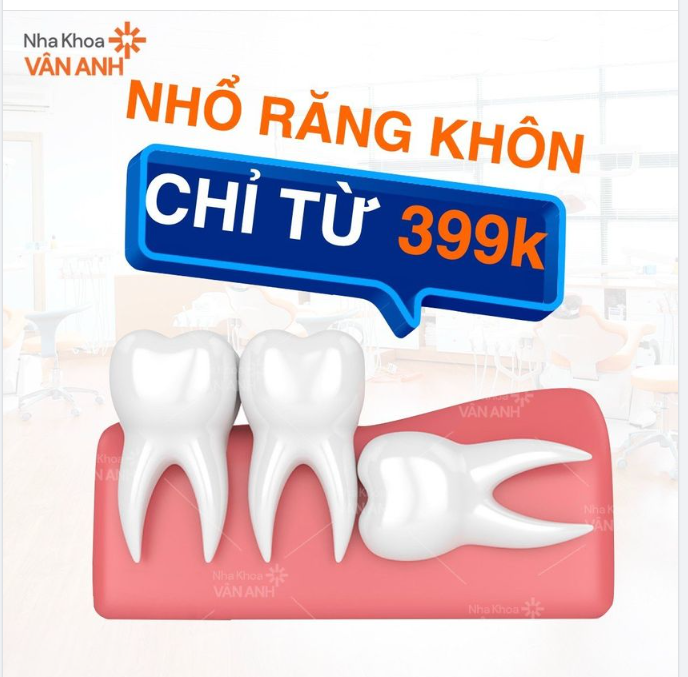 Nhổ răng khôn máy siêu âm piezotome tại Nha khoa Vân Anh