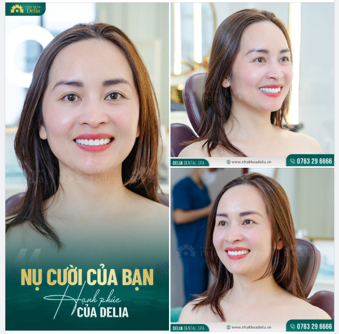 Nha khoa Delia tin rằng, với nụ cười rạng rỡ luôn nở trên môi, chị Trang sẽ tạo được những ấn tượng khó quên với khách hàng và giúp công việc của chị gặp nhiều may mắn hơn.