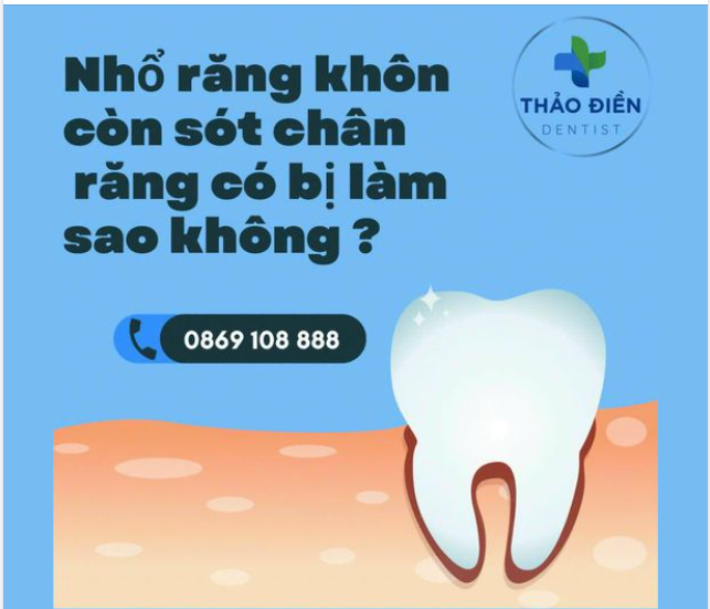 NHỔ RĂNG KHÔN CÒN SÓT CHÂN RĂNG CÓ BỊ LÀM SAO KHÔNG