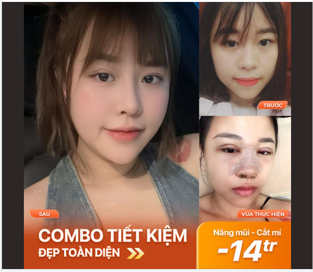 COMBO TIẾT KIỆM - ĐẸP TOÀN DIỆN