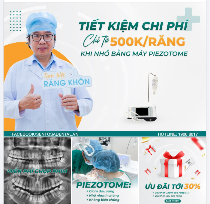 TIẾT KIỆM CHI PHÍ - CHỈ TỪ 500K/RĂNG KHI NHỔ BẰNG MÁY PIEZOTOME