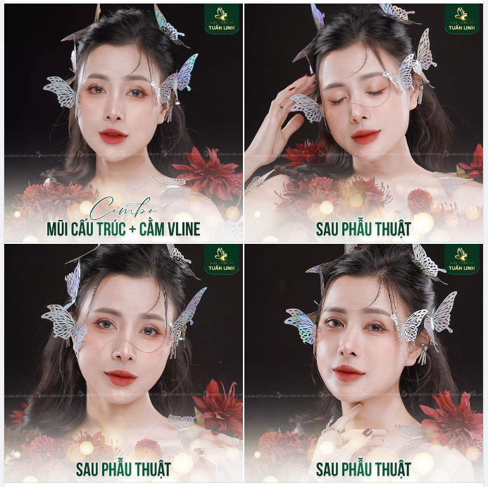 Thẩm mỹ combo bạn sẽ được gì