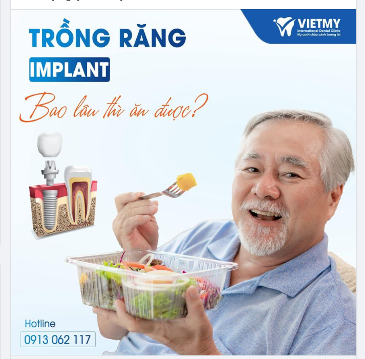 BẠN ĐÃ BIẾT !!!  TRỒNG RĂNG IMPLANT BAO LÂU THÌ CÓ THỂ ĂN ĐƯỢC ?