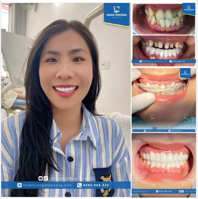 “Chuyến đi Đà Nẵng thành công nhất là kết thúc được ca của em ấy.” - Bác sĩ Tuấn chia sẻ sau khi giúp bạn Hoài Thư sửa lại “sai lầm tuổi trẻ.”