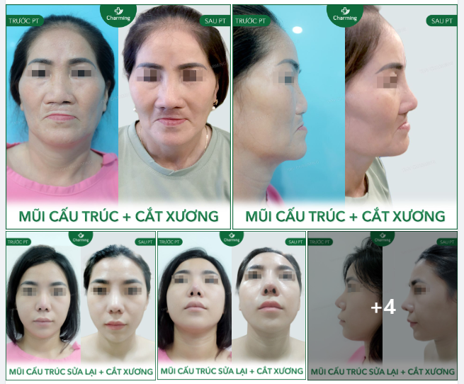Một vài hình ảnh dáng cấu trúc tai Thẩm mỹ viện, Charming tổng hợp lại cho Khách hàng dễ tham khảo hơn nhé ạ!