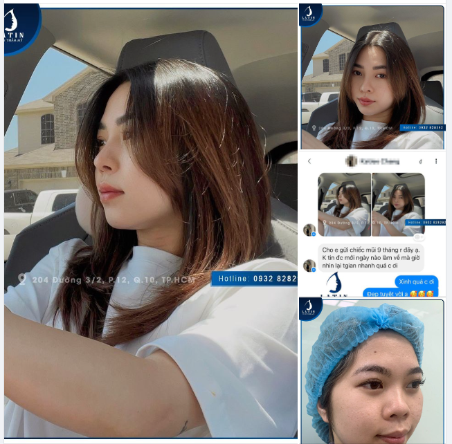 Latin chả có gì ngoài chiếc feedback mũi 9 tháng tuổi được gửi về từ Mỹ